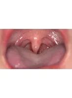 相楽さゆな(さがらさゆな) - 「【歯・口腔フェチ】新人女優相楽さゆなちゃんの口内観察＆巨大女フェチ」わかしラボWAKA-078 相楽さゆな 9 サンプル画像