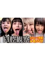 【特価】口腔観察VOL.2 4名55分お買い得セット サンプル画像