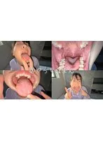谷田かりな(たにだかりな) - 【個人撮影】谷田かりな 開口器で口内観察デカ舌を要チェック サンプル画像