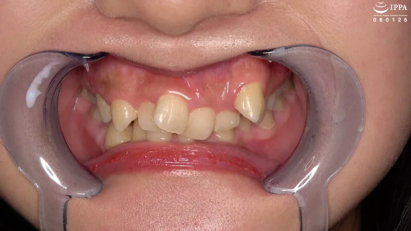 「【歯・口腔フェチ】新人女優相楽さゆなちゃんの口内観察＆巨大女フェチ」わかしラボWAKA-078 相楽さゆな 9 サンプル画像 2