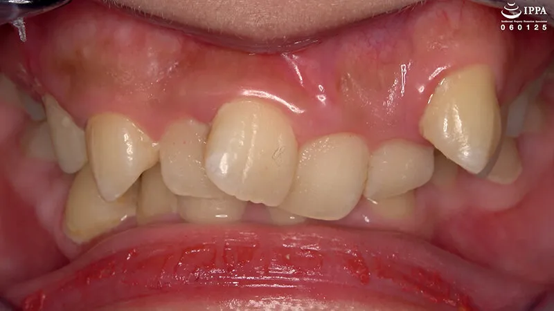 「【歯・口腔フェチ】新人女優相楽さゆなちゃんの口内観察＆巨大女フェチ」わかしラボWAKA-078 相楽さゆな 9 サンプル画像 3