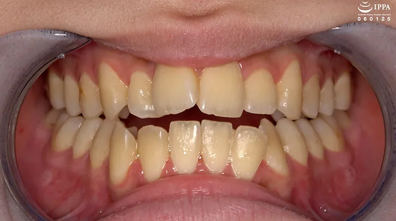 「【歯・口腔フェチ】新人女優牧河柚乃ちゃんの口内観察＆巨大女フェチ」牧河柚乃 サンプル画像 3