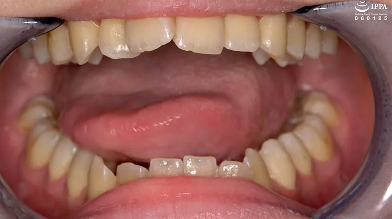 「【歯・口腔フェチ】新人女優牧河柚乃ちゃんの口内観察＆巨大女フェチ」牧河柚乃 サンプル画像 4