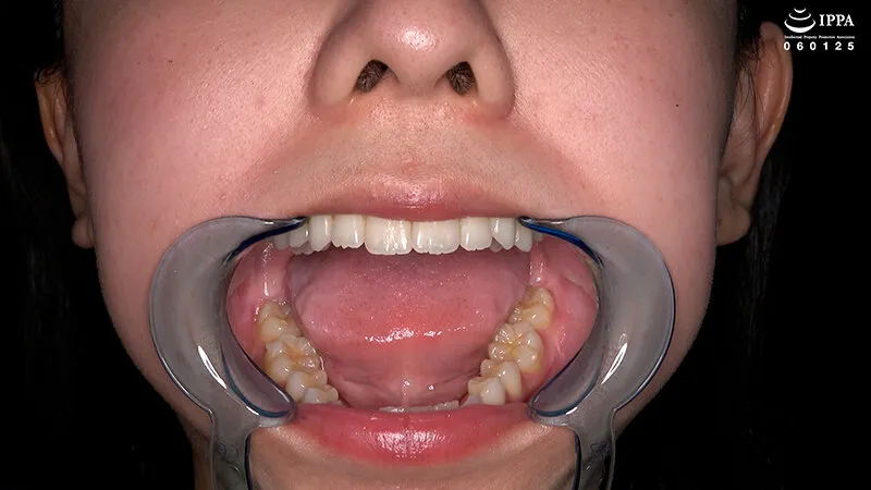 「【激レア】超貴重な口内・歯・のどちんこ観察＆小魚咀嚼巨大女プレイ！」加護まり サンプル画像 2