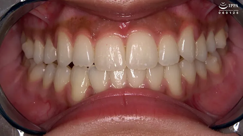 「【激レア】超貴重な口内・歯・のどちんこ観察＆小魚咀嚼巨大女プレイ！」加護まり サンプル画像 3