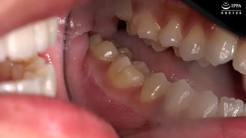 「【激レア】超貴重な口内・歯・のどちんこ観察＆小魚咀嚼巨大女プレイ！」加護まり サンプル画像 4