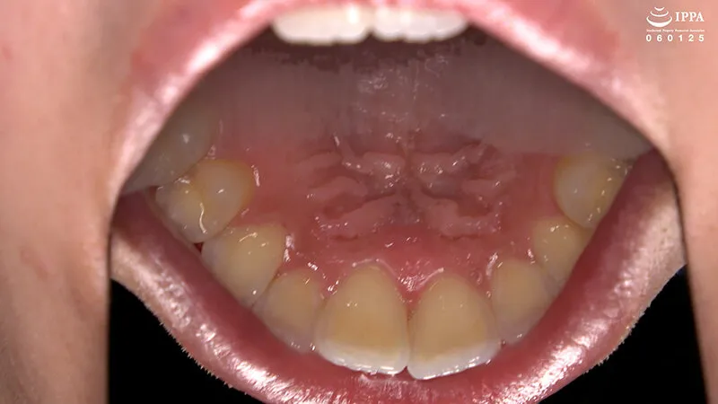 「【激レア】超貴重な口内・歯・のどちんこ観察＆小魚咀嚼巨大女プレイ！」加護まり サンプル画像 5