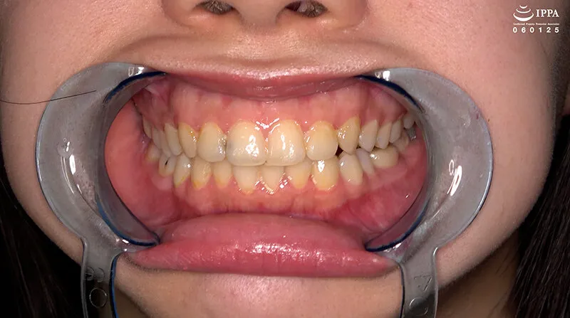 【激レア】「超貴重な口内・歯・のどちんこ観察＆小魚咀嚼巨大女プレイ！」甘井くるみ サンプル画像 4