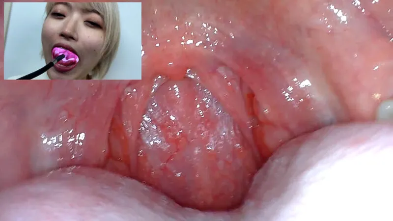 街角で声をかけて口内観察させてもらう 美容部員 はるのちゃん サンプル画像 16