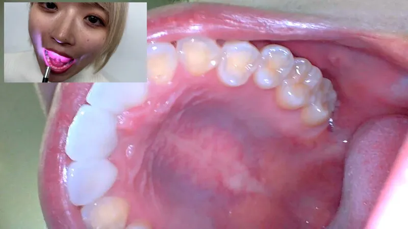 街角で声をかけて口内観察させてもらう 美容部員 はるのちゃん サンプル画像 17