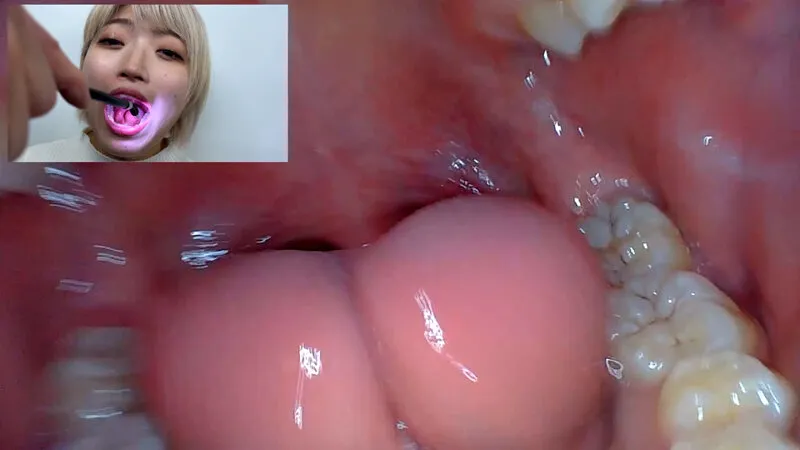 街角で声をかけて口内観察させてもらう 美容部員 はるのちゃん サンプル画像 18