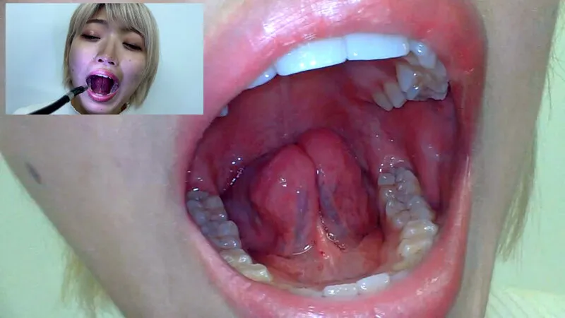 街角で声をかけて口内観察させてもらう 美容部員 はるのちゃん サンプル画像 19