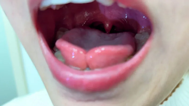 街角で声をかけて口内観察させてもらう 美容部員 はるのちゃん サンプル画像 5