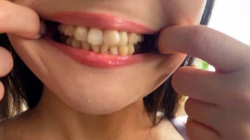 街角で声をかけて口内観察させてもらう ファーストフード店パート みおりさん サンプル画像 10