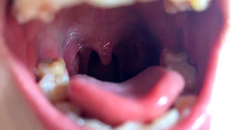 街角で声をかけて口内観察させてもらう ファーストフード店パート みおりさん サンプル画像 19