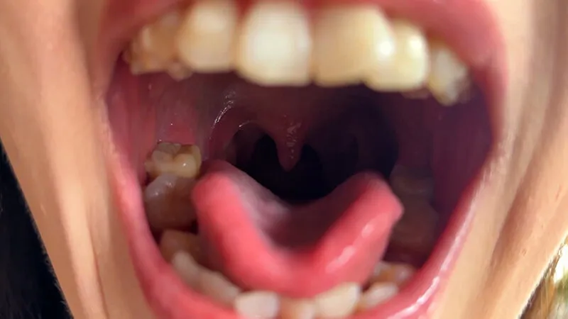 街角で声をかけて口内観察させてもらう ファーストフード店パート みおりさん サンプル画像 3