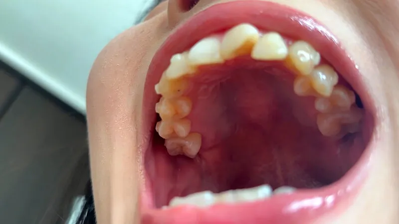 街角で声をかけて口内観察させてもらう ファーストフード店パート みおりさん サンプル画像 5