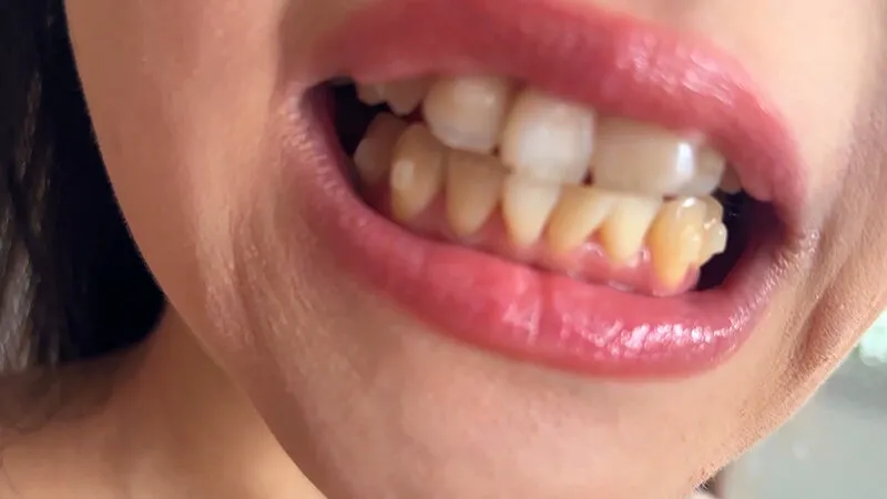 街角で声をかけて口内観察させてもらう ファーストフード店パート みおりさん サンプル画像 6