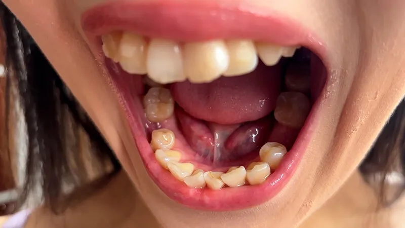 街角で声をかけて口内観察させてもらう ファーストフード店パート みおりさん サンプル画像 7