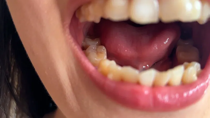 街角で声をかけて口内観察させてもらう ファーストフード店パート みおりさん サンプル画像 8