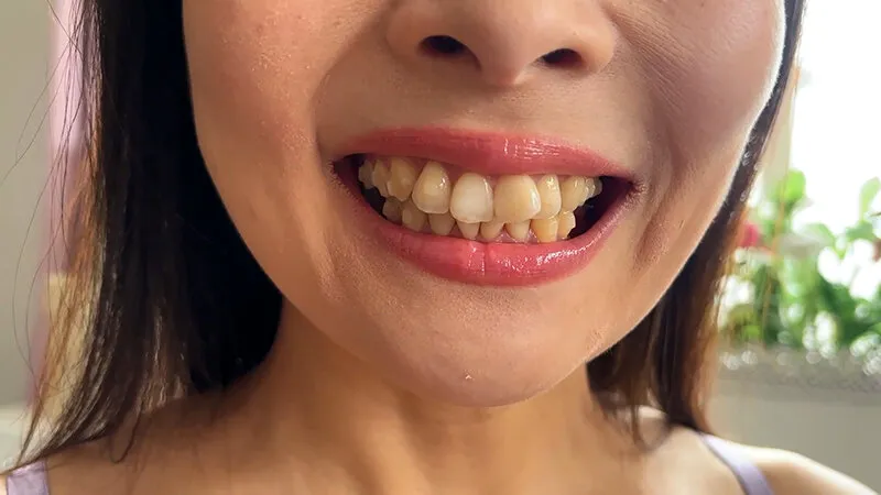 街角で声をかけて口内観察させてもらう ファーストフード店パート みおりさん サンプル画像 9