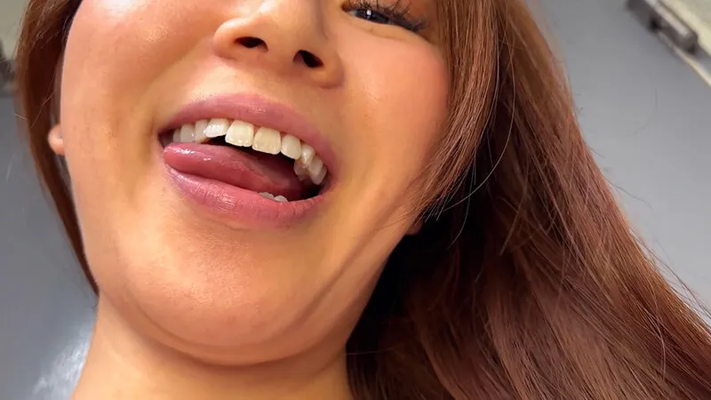 街角で声をかけて口内観察させてもらう 商社営業 れなちゃん サンプル画像 16