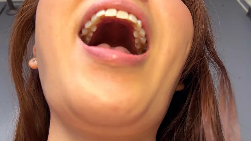 街角で声をかけて口内観察させてもらう 商社営業 れなちゃん サンプル画像 17