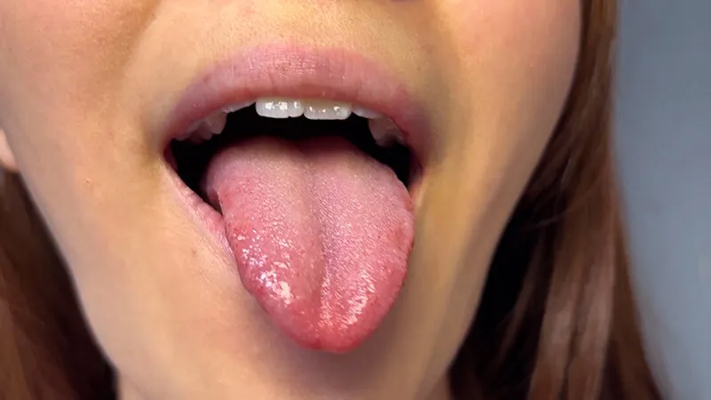 街角で声をかけて口内観察させてもらう 商社営業 れなちゃん サンプル画像 19