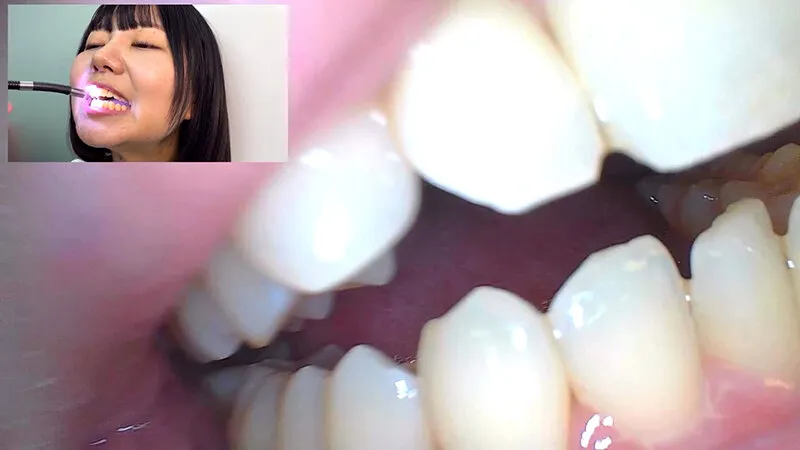 街角で声をかけて口内観察させてもらう テレビ局AD みゆりちゃん サンプル画像 15