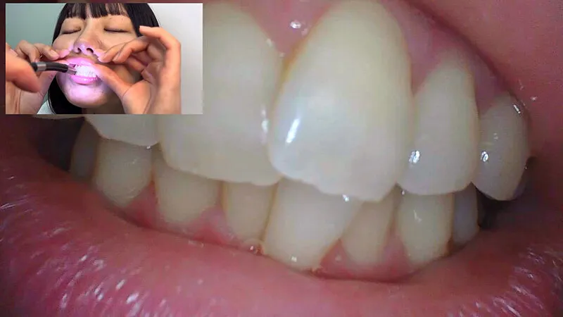 街角で声をかけて口内観察させてもらう テレビ局AD みゆりちゃん サンプル画像 16