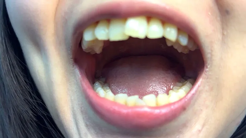 街角で声をかけて口内観察させてもらう テレビ局AD みゆりちゃん サンプル画像 2