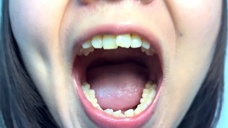 街角で声をかけて口内観察させてもらう テレビ局AD みゆりちゃん サンプル画像 3