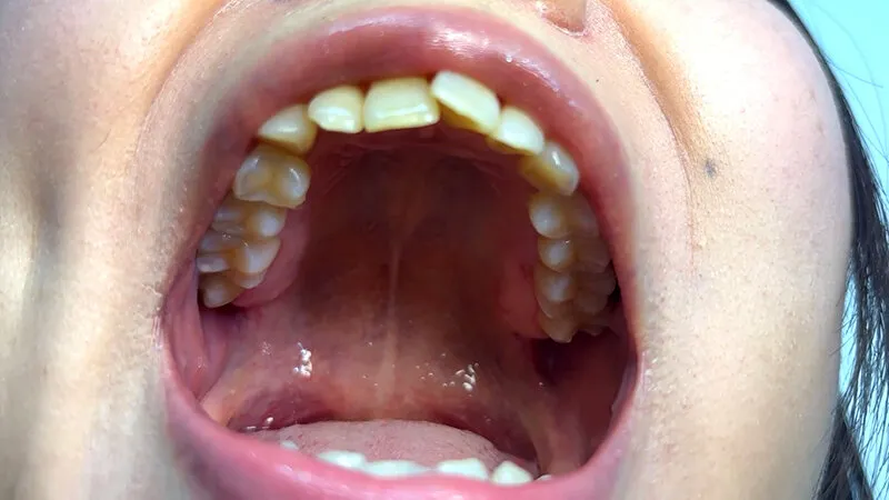 街角で声をかけて口内観察させてもらう テレビ局AD みゆりちゃん サンプル画像 4