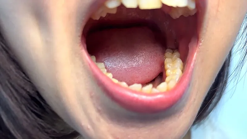 街角で声をかけて口内観察させてもらう テレビ局AD みゆりちゃん サンプル画像 5