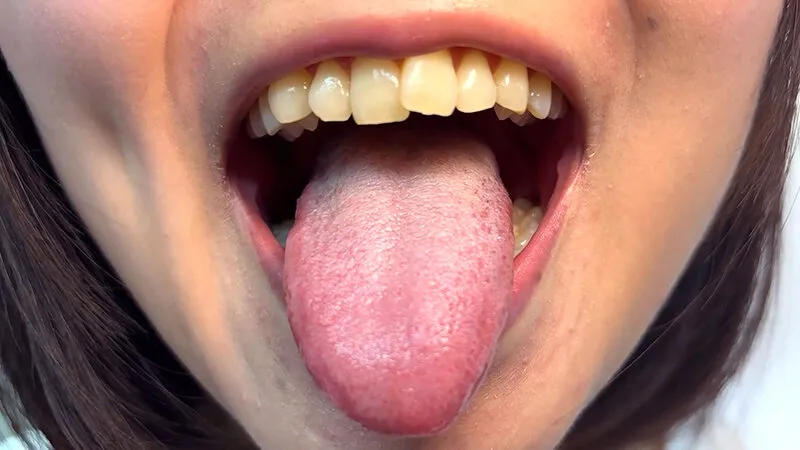 街角で声をかけて口内観察させてもらう テレビ局AD みゆりちゃん サンプル画像 7