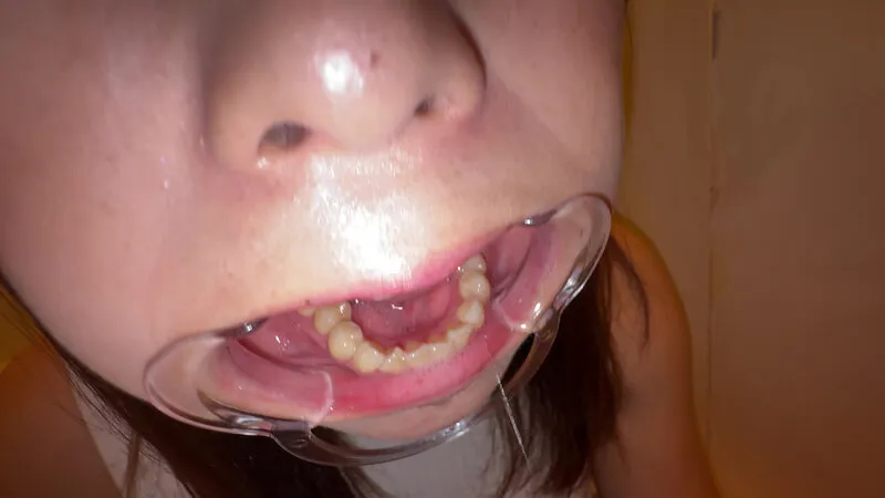 【個人撮影】赤城穂波 初喉チンコ触り＆超長舌を開口器で観察 サンプル画像 20