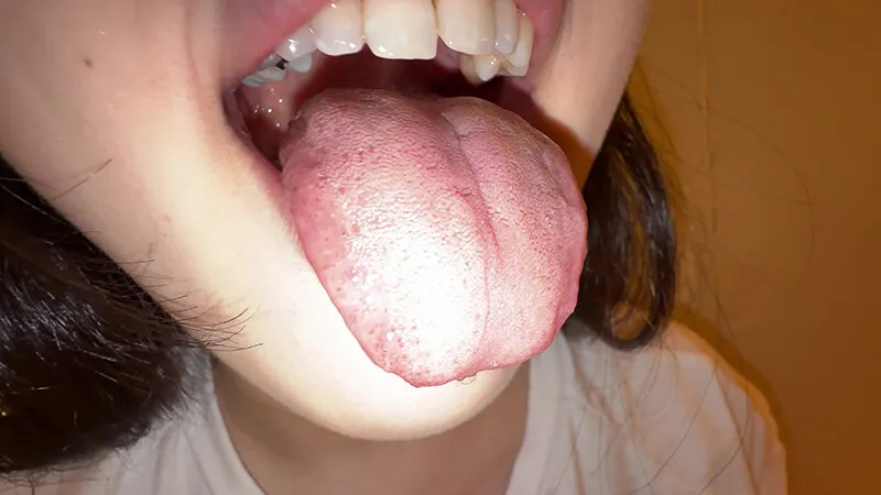 【個人撮影】横山夏希の舌ブラシで「汚舌苔」採取 サンプル画像 1