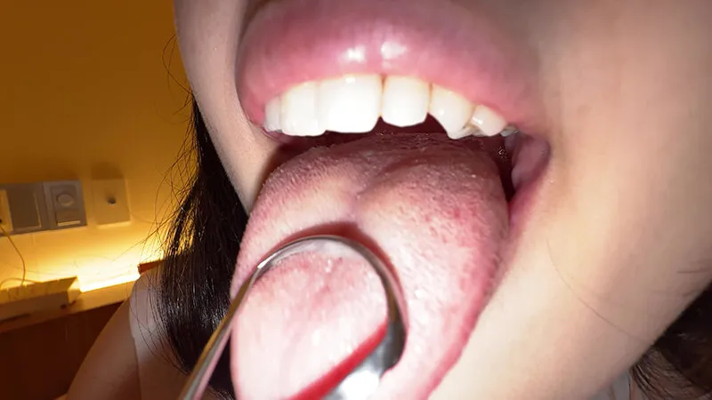 【個人撮影】横山夏希の舌ブラシで「汚舌苔」採取 サンプル画像 10