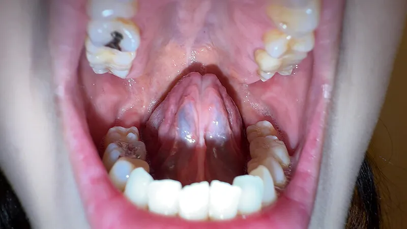 【個人撮影】横山夏希の舌ブラシで「汚舌苔」採取 サンプル画像 2