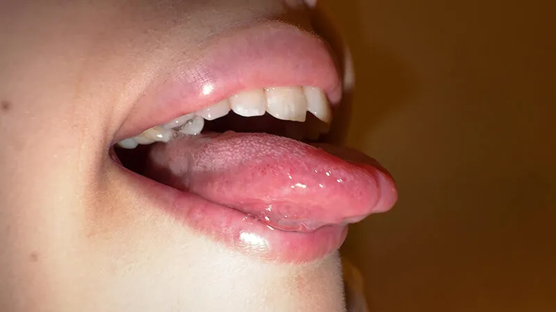 【個人撮影】横山夏希の舌ブラシで「汚舌苔」採取 サンプル画像 3