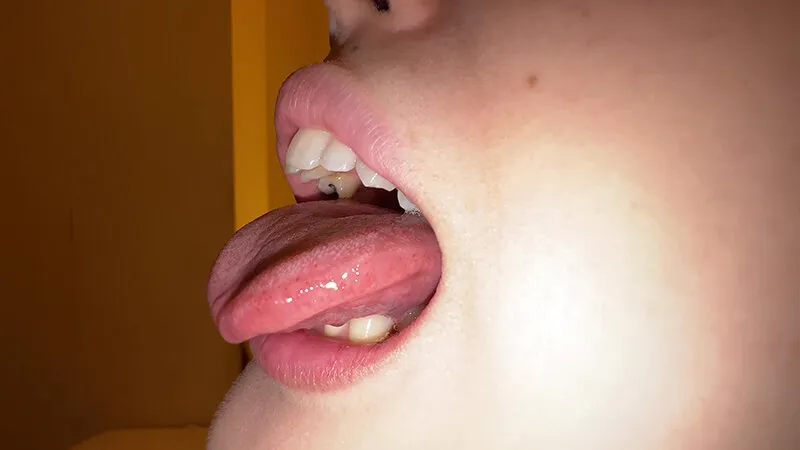【個人撮影】横山夏希の舌ブラシで「汚舌苔」採取 サンプル画像 5