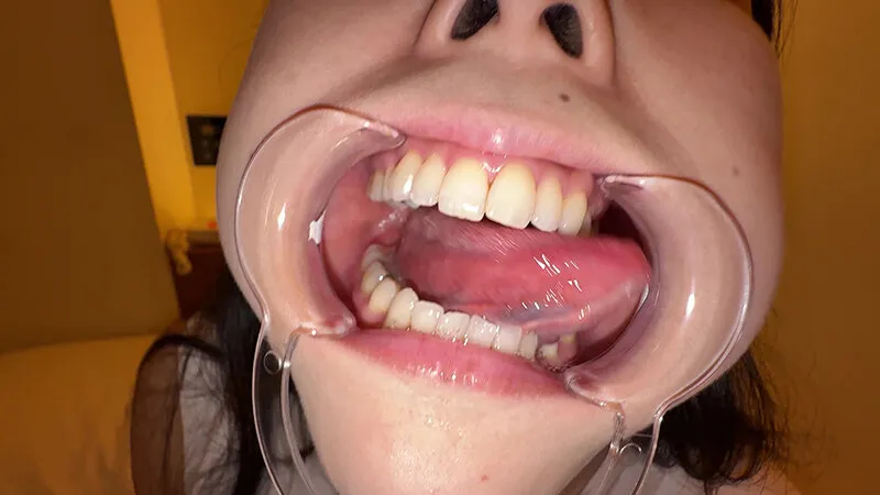 【個人撮影】横山夏希の喉チンコ触り＆肉厚舌を開口器で観察 サンプル画像 11