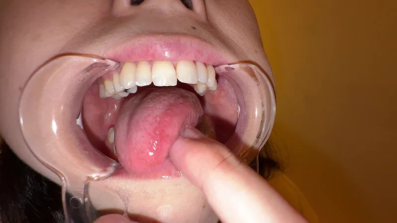 【個人撮影】横山夏希の喉チンコ触り＆肉厚舌を開口器で観察 サンプル画像 17