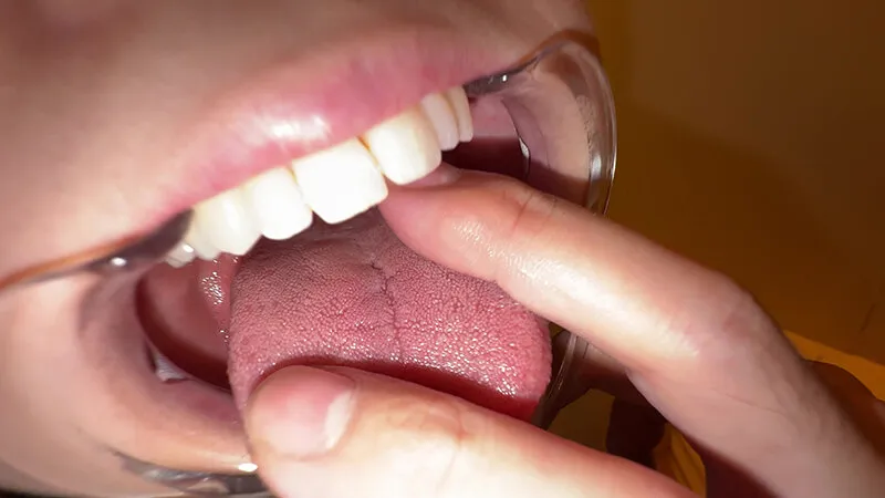 【個人撮影】横山夏希の喉チンコ触り＆肉厚舌を開口器で観察 サンプル画像 18