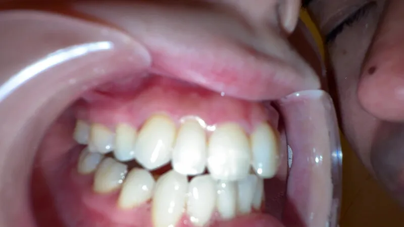 【個人撮影】横山夏希の喉チンコ触り＆肉厚舌を開口器で観察 サンプル画像 19