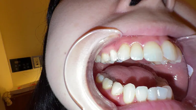 【個人撮影】横山夏希の喉チンコ触り＆肉厚舌を開口器で観察 サンプル画像 20
