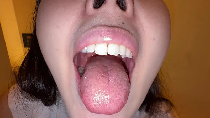 【個人撮影】横山夏希の喉チンコ触り＆肉厚舌を開口器で観察 サンプル画像 4
