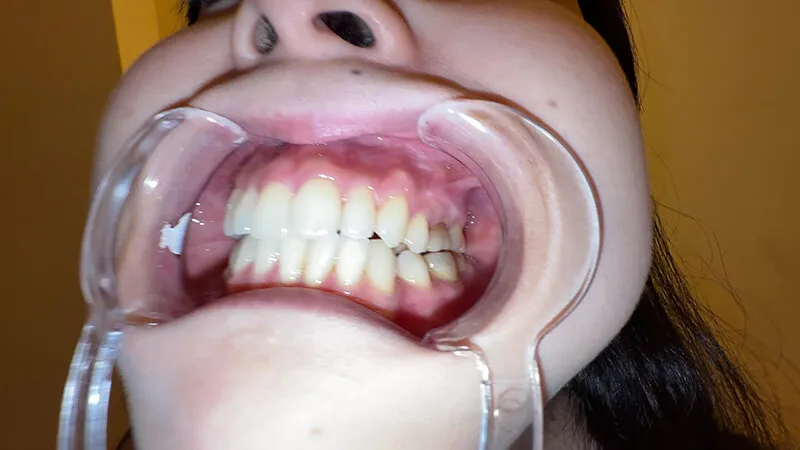 【個人撮影】横山夏希の喉チンコ触り＆肉厚舌を開口器で観察 サンプル画像 7