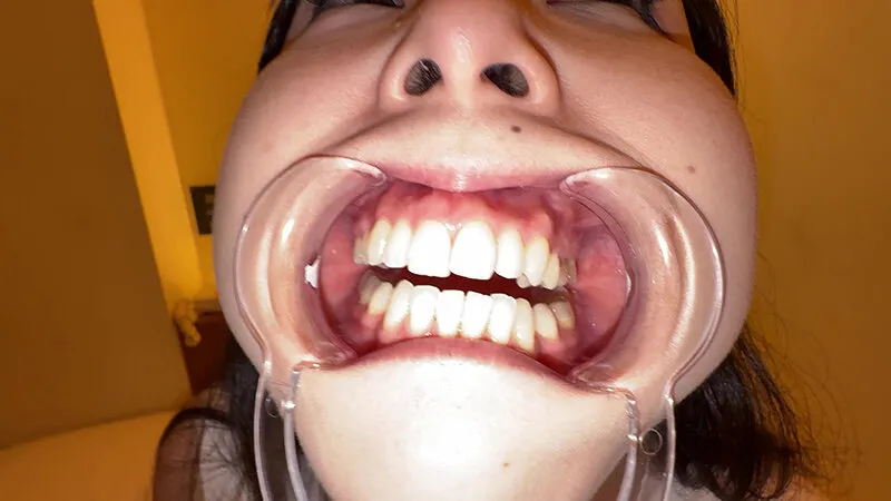 【個人撮影】横山夏希の喉チンコ触り＆肉厚舌を開口器で観察 サンプル画像 9