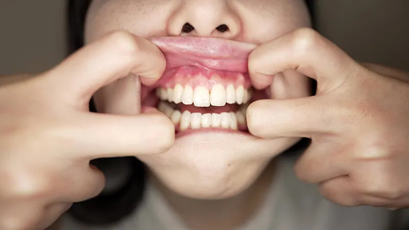 【個人撮影】横山夏希 変態男のわがままリクエスト 口臭チェック！ サンプル画像 10